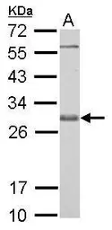 Anti-Bcl-X antibody used in Western Blot (WB). GTX105661