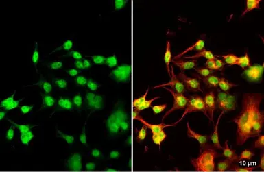 Anti-Nkx2.5 antibody used in Immunocytochemistry/ Immunofluorescence (ICC/IF). GTX105711