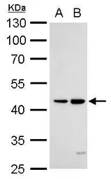 Anti-DR3 antibody used in Western Blot (WB). GTX105713