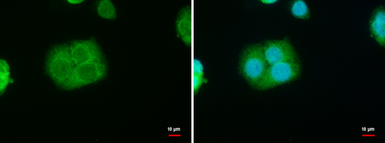 Anti-StAR antibody used in Immunocytochemistry/ Immunofluorescence (ICC/IF). GTX105716