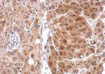 Anti-StAR antibody used in IHC (Paraffin sections) (IHC-P). GTX105716