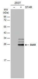 Anti-StAR antibody used in Western Blot (WB). GTX105716