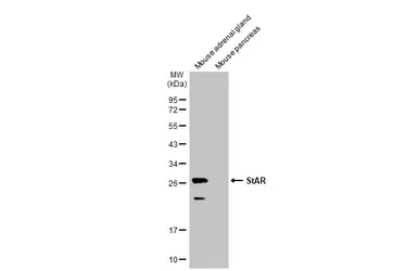 Anti-StAR antibody used in Western Blot (WB). GTX105716