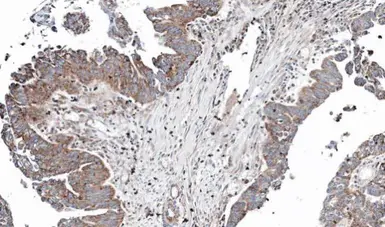 Anti-NT5C2 antibody [N2C1], Internal used in IHC (Paraffin sections) (IHC-P). GTX105719