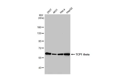 Anti-TCP1 theta antibody [N2C2], Internal used in Western Blot (WB). GTX105725