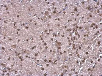 Anti-NFIB antibody [N1C2] used in IHC (Paraffin sections) (IHC-P). GTX105749