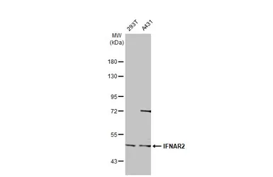 Anti-IFNAR2 antibody used in Western Blot (WB). GTX105770