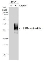 Anti-IL13 Receptor alpha 1 antibody used in Western Blot (WB). GTX105788