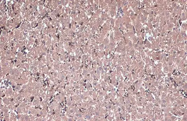Anti-IL13 Receptor alpha 1 antibody used in IHC (Paraffin sections) (IHC-P). GTX105788