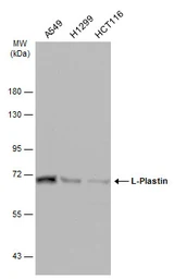 Anti-L-Plastin antibody used in Western Blot (WB). GTX105789