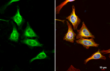 Anti-Folate Receptor beta antibody used in Immunocytochemistry/ Immunofluorescence (ICC/IF). GTX105822