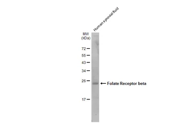 Anti-Folate Receptor beta antibody used in Western Blot (WB). GTX105822
