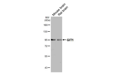 Anti-GIT1 antibody [N3C2], Internal used in Western Blot (WB). GTX105824