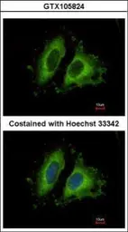 Anti-GIT1 antibody [N3C2], Internal used in Immunocytochemistry/ Immunofluorescence (ICC/IF). GTX105824