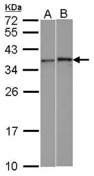 Anti-WBSCR22 antibody used in Western Blot (WB). GTX105840