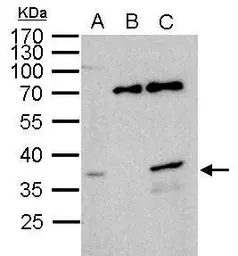 Anti-WBSCR22 antibody used in Immunoprecipitation (IP). GTX105840