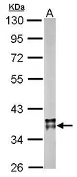 Anti-MDH2 antibody used in Western Blot (WB). GTX105870