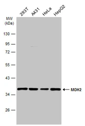 Anti-MDH2 antibody used in Western Blot (WB). GTX105870