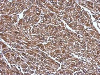 Anti-RABGGTB antibody used in IHC (Paraffin sections) (IHC-P). GTX105874