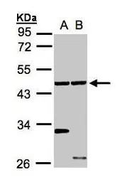 Anti-ETNK1 antibody [N2C3] used in Western Blot (WB). GTX105887