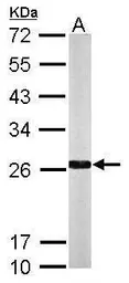 Anti-NQO2 antibody used in Western Blot (WB). GTX105899