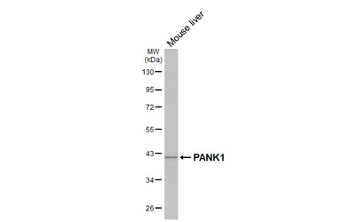 Anti-PANK1 antibody [N3C3] used in Western Blot (WB). GTX105920