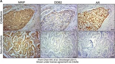 Anti-NRIP antibody used in IHC (Paraffin sections) (IHC-P). GTX105954