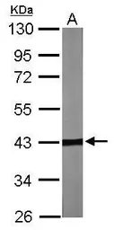 Anti-TBCC antibody [N1C3] used in Western Blot (WB). GTX105962