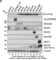 Anti-Wnt11 antibody used in Western Blot (WB). GTX105971