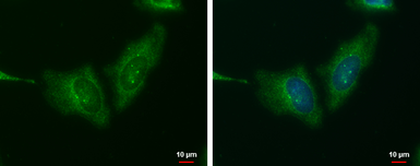 Anti-Wnt11 antibody used in Immunocytochemistry/ Immunofluorescence (ICC/IF). GTX105971