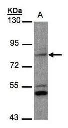 Anti-PHEX antibody [N1N3] used in Western Blot (WB). GTX105991