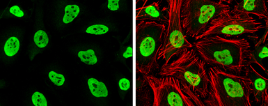 Anti-Rad21 antibody used in Immunocytochemistry/ Immunofluorescence (ICC/IF). GTX106012