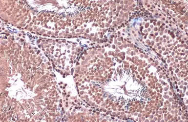 Anti-Rad21 antibody used in IHC (Paraffin sections) (IHC-P). GTX106012