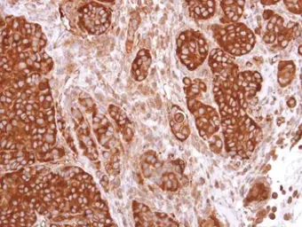 Anti-CaMKIV antibody [N1C3] used in IHC (Paraffin sections) (IHC-P). GTX106023