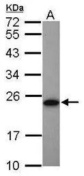 Anti-Adenylate kinase 1 antibody [N1C3] used in Western Blot (WB). GTX106079