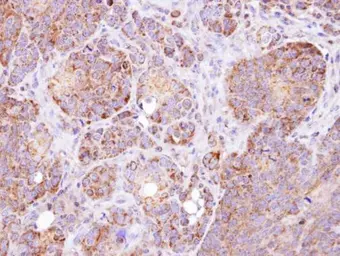 Anti-GSTZ1 antibody [N1C3] used in IHC (Paraffin sections) (IHC-P). GTX106109