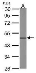 Anti-SDCCAG3 antibody [C1C3] used in Western Blot (WB). GTX106180