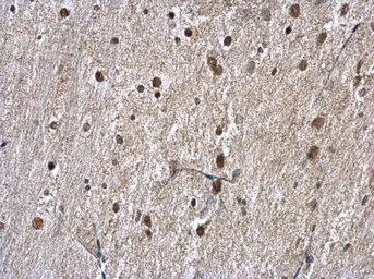 Anti-hnRNP A1 antibody used in IHC (Paraffin sections) (IHC-P). GTX106208
