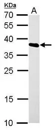 Anti-hnRNP A1 antibody used in Western Blot (WB). GTX106208