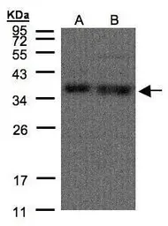 Anti-hnRNP A1 antibody used in Western Blot (WB). GTX106208