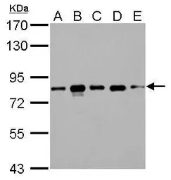 Anti-CD2AP antibody used in Western Blot (WB). GTX106235