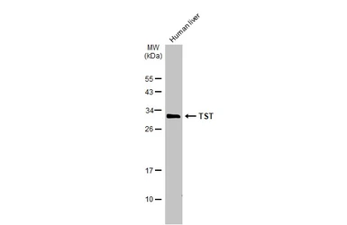 Anti-TST antibody used in Western Blot (WB). GTX106257