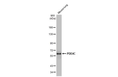 Anti-PDE4C antibody [N3C3] used in Western Blot (WB). GTX106268