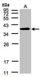 Anti-SPFH2 antibody [C2C3], C-term used in Western Blot (WB). GTX106277