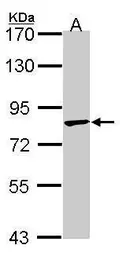 Anti-TRIM36 antibody [C3], C-term used in Western Blot (WB). GTX106290