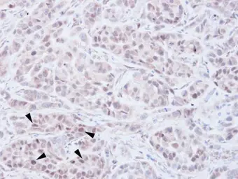 Anti-NSD2 antibody [N1], N-term used in IHC (Paraffin sections) (IHC-P). GTX106306