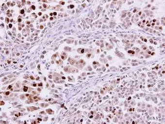 Anti-KPNA2 antibody [C3], C-term used in IHC (Paraffin sections) (IHC-P). GTX106323