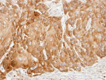 Anti-VDP / p115 antibody [C3], C-term used in IHC (Paraffin sections) (IHC-P). GTX106355