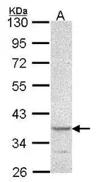 Anti-PSCDBP antibody [N1], N-term used in Western Blot (WB). GTX106363