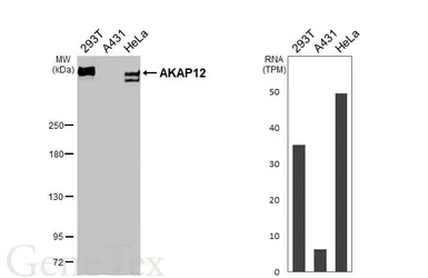 Anti-AKAP12 antibody [C3], C-term used in Western Blot (WB). GTX106373